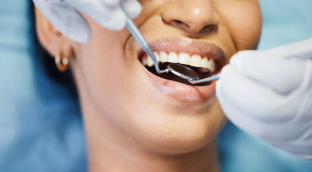 Best Urgent Care for Lost Fillings or Crowns in Chillicothe, OH