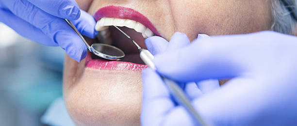 Best Emergency Gum Treatment in Chillicothe, OH